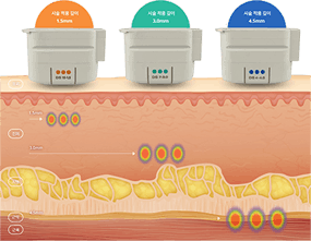 3단계 깊이 조절